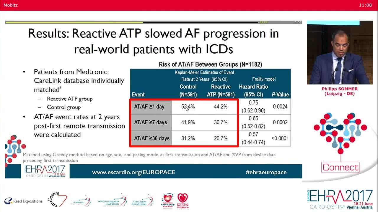 Atrial Fibrillation.