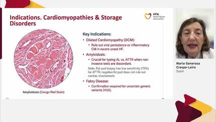 Diagnostic work-up of advanced heart failure