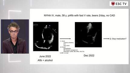 Heart Failure Made Easy