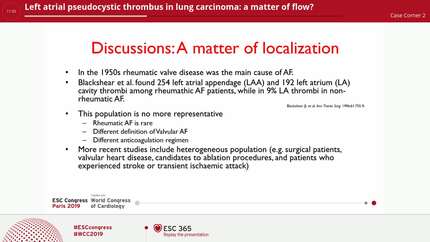 Left atrial pseudocystic thrombus in lung carcinoma: a matter of flow?