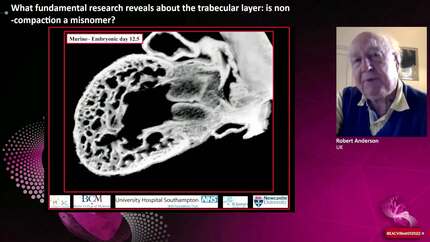 What fundamental research reveals about the trabecular layer: is non-compaction a misnomer?