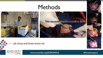 Electrical isolation by electroporation of right ventricular myocardium in an ex-vivo beating porcine heart: a potential novel use of the alert internal cardioversion catheter