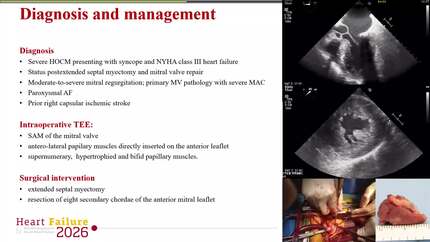 Presentation thumbnail