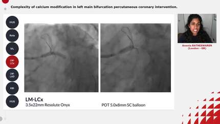 Complexity of calcium modification in left main bifurcation percutaneous coronary intervention.