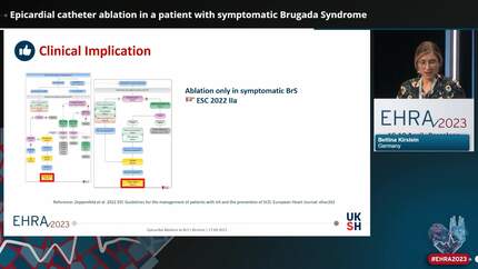 Ventricular arrhythmias and SCD Round 1