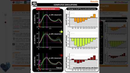 The role of atrial pacing site in reducing filling pressures by accelerated pacing in virtual HFpEF patients