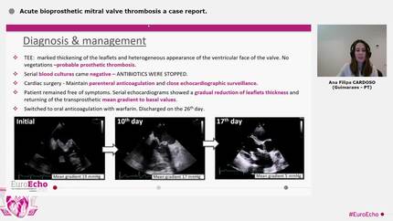 Acute bioprosthetic mitral valve thrombosis a case report.