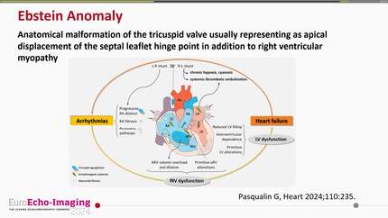 Presentation thumbnail