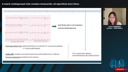 A nearly misdiagnosed wide complex tachycardia: all algorithms have flaws.