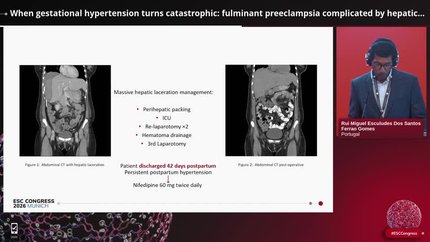 Presentation thumbnail