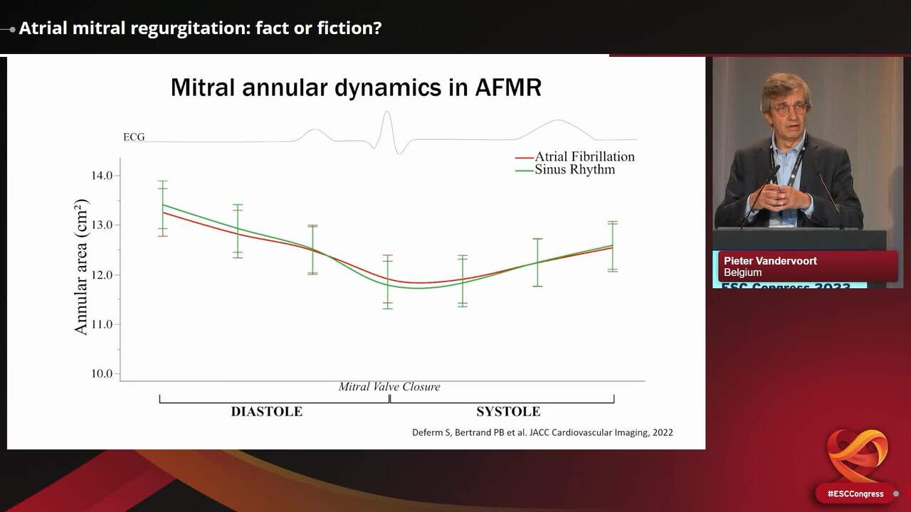 Atrial mitral regurgitation: fact or fiction?
