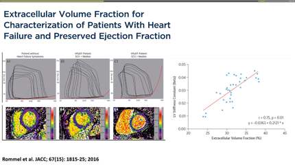 Novel imaging technology to assess diastolic cardiac function at rest and exercise.