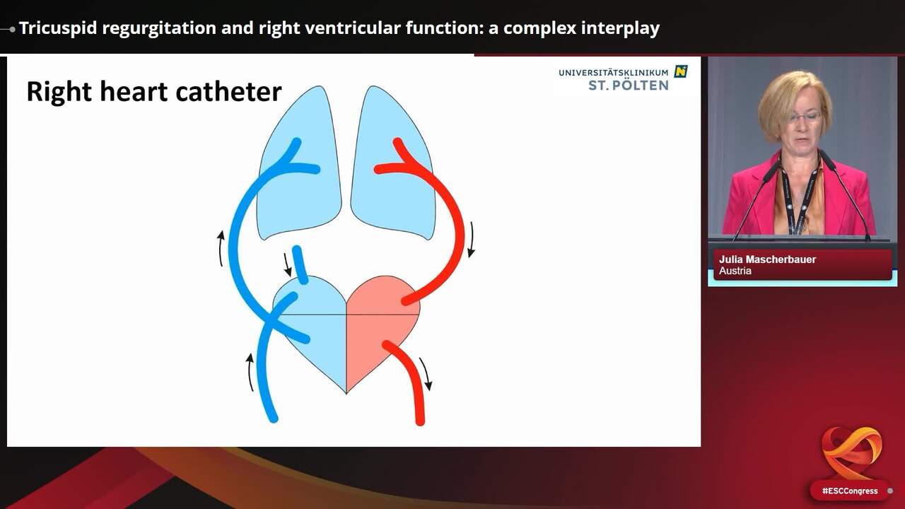 Tricuspid regurgitation and right ventricular function: a complex interplay