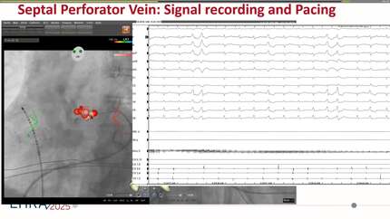 Presentation thumbnail