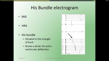Presentation thumbnail