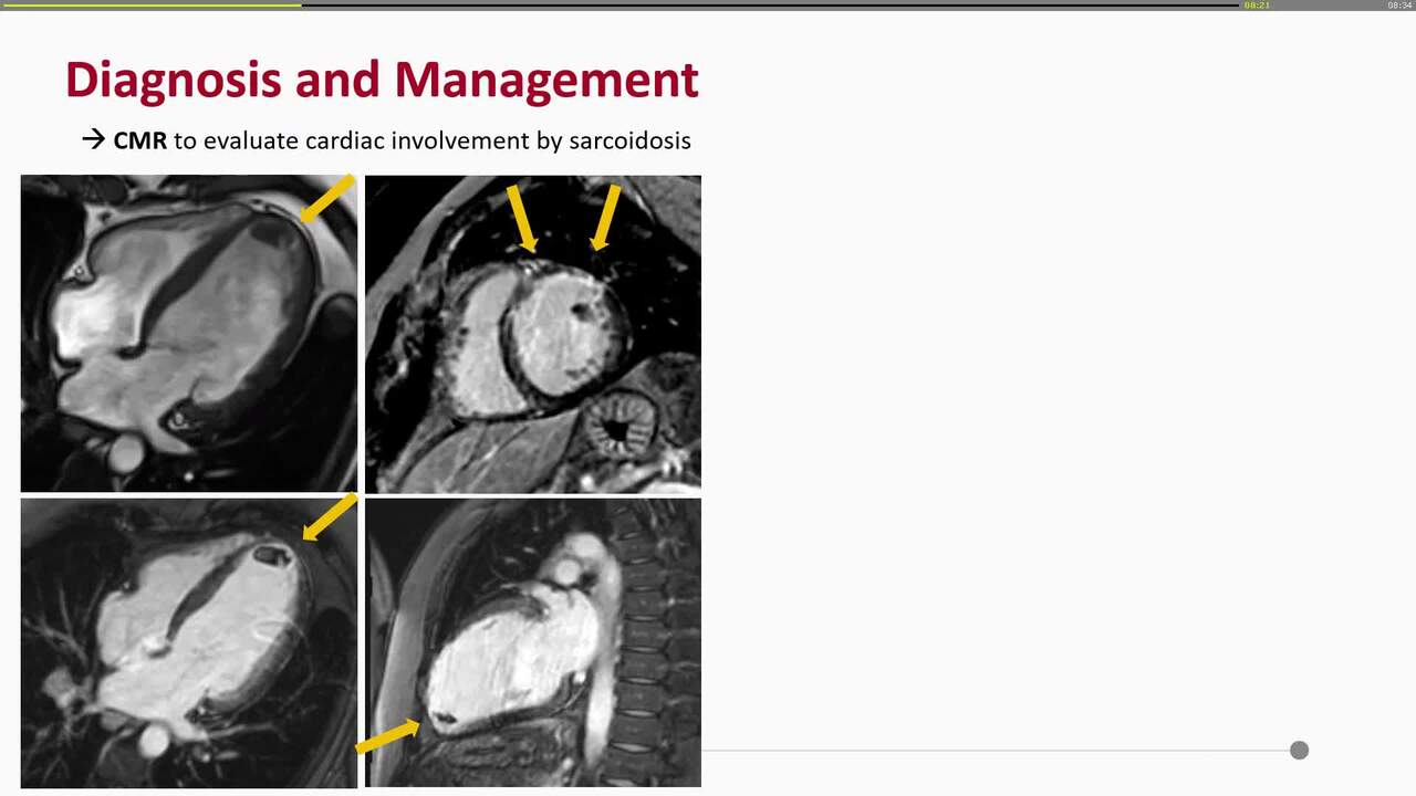 Presentation thumbnail