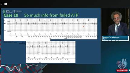 Difficult device tracing: how to deal with it