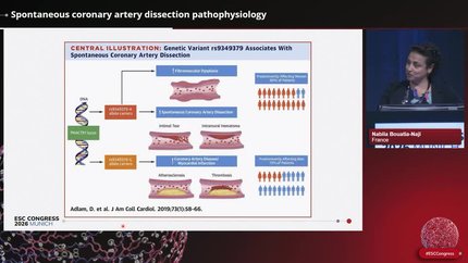 Spontaneous coronary artery dissection pathophysiology