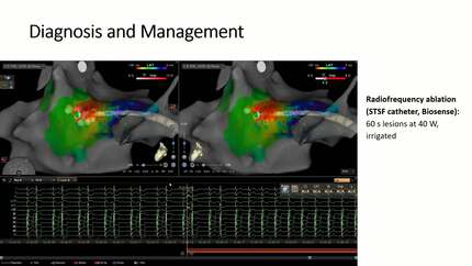 Presentation thumbnail