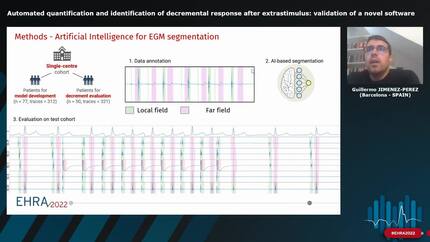 Automated quantification and identification of decremental response after extrastimulus: validation of a novel software