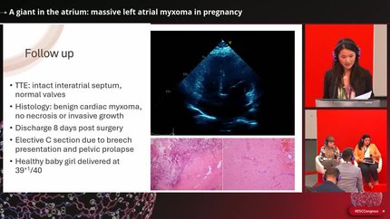 Presentation thumbnail