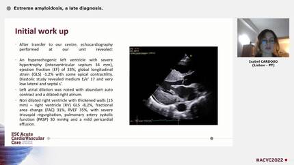 Extreme amyloidosis, a late diagnosis.