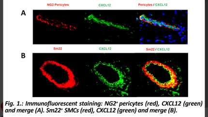 Effects of pericyte and smooth muscle specific knock-out of CXCL12 on cardiac function after myocardial ischemia in mice 