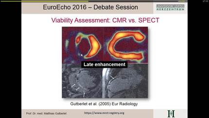 For assessment of myocardial viability I only need LGE-MRI.