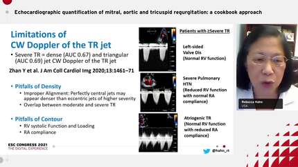 Echocardiographic quantification of mitral, aortic and tricuspid regurgitation: a cookbook approach