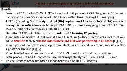Ultra-high-density mapping of epicardial to endocardial breakthrough after previous successful cavotricuspid isthmus ablation