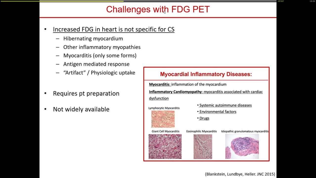 Sarcoidosis - Clinical perspective (+US) 