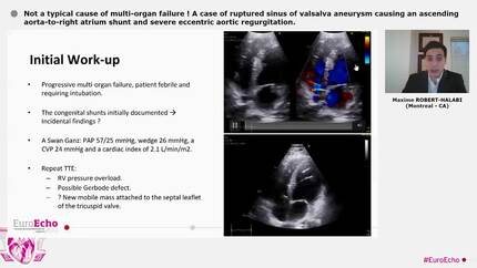 Not a typical cause of multi-organ failure ! A case of ruptured sinus of valsalva aneurysm causing an ascending aorta-to-right atrium shunt and severe eccentric aortic regurgitation.