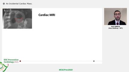An Incidental Cardiac Mass
