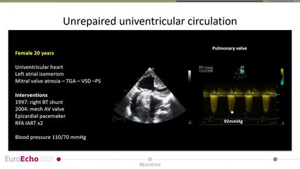 Presentation thumbnail