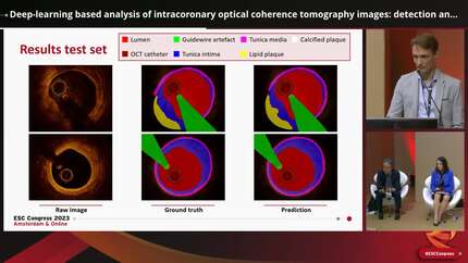 Deep-learning based analysis of intracoronary optical coherence tomography images: detection and characterization of lipid plaques