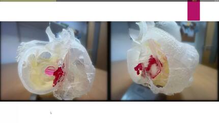 Presentation thumbnail