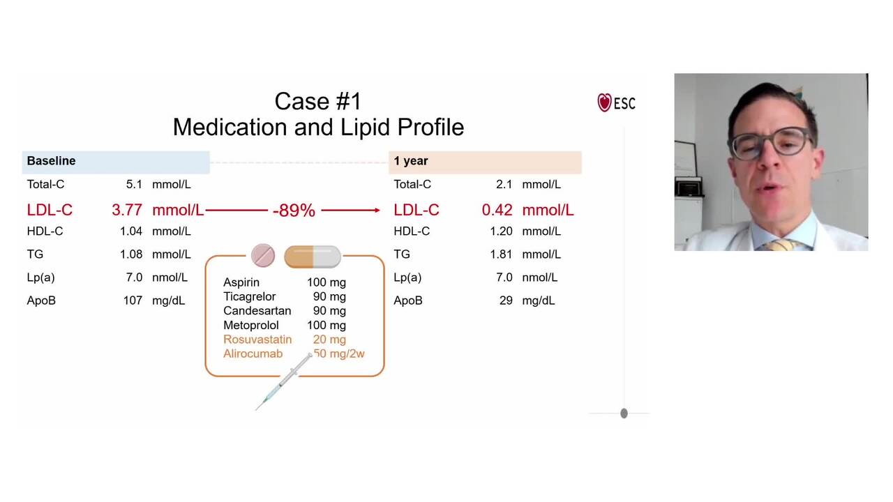 Imaging of subclinical coronary atherosclerosis: implications for intensive lipid-lowering therapy