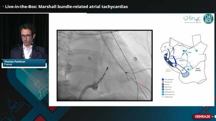 Live-in-the-Box: atrial tachycardias post-atrial fibrillation ablation  