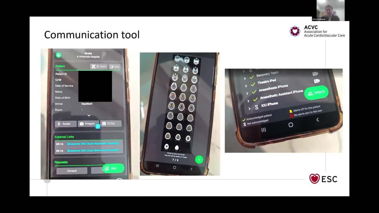 ACVC Talks - episode 5 - Acute Cardiovascular Thromboembolic Diseases