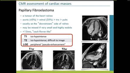 Presentation thumbnail