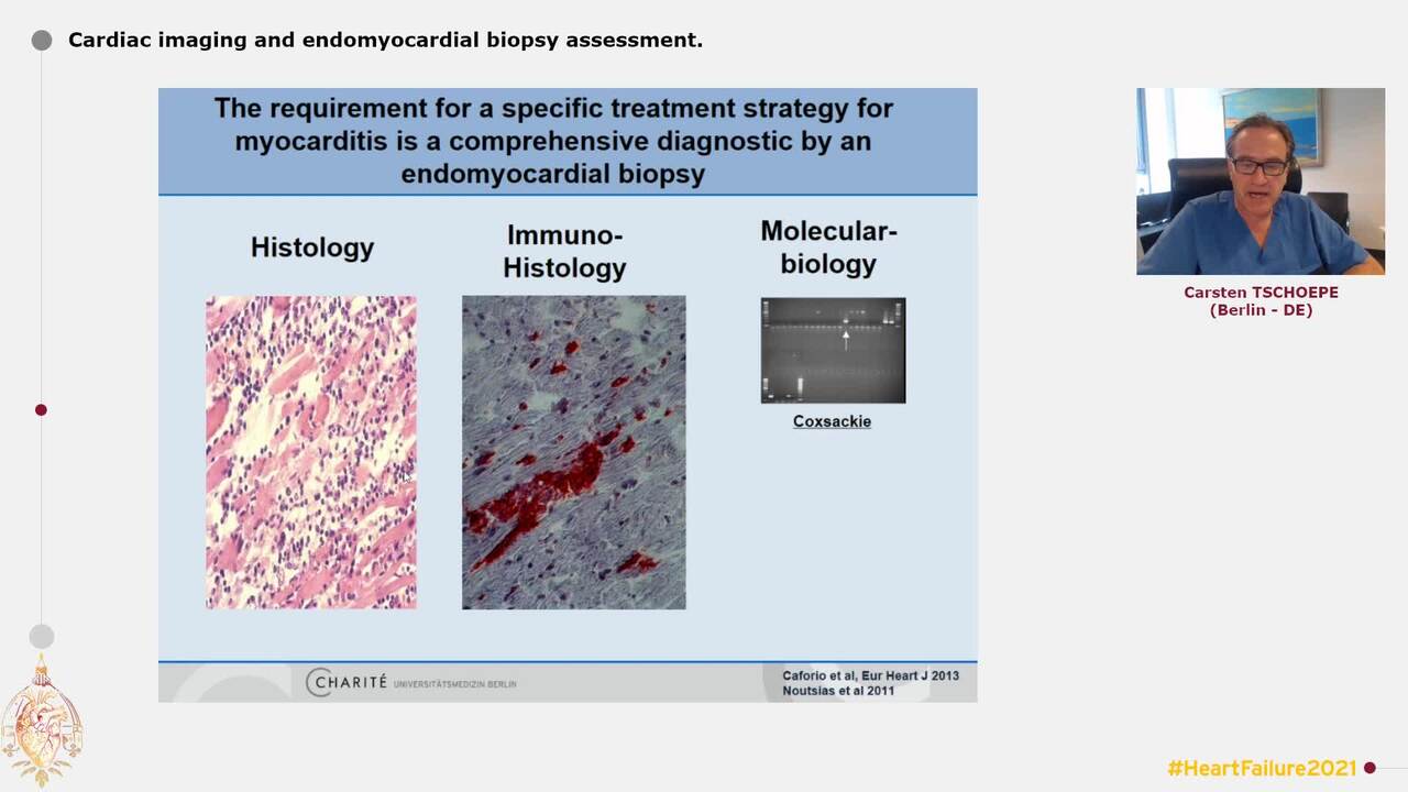 New advances in acute myocarditis