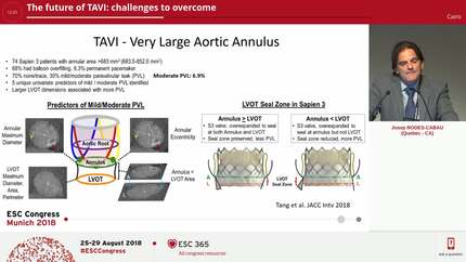 The future of TAVI: challenges to overcome