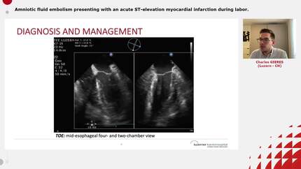 Presentation thumbnail