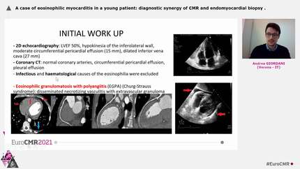 A case of eosinophilic myocarditis in a young patient: diagnostic synergy of CMR and endomyocardial biopsy
.