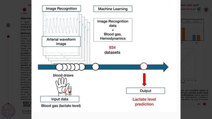 Image recognition of radial arterial waveforms predicts lactate levels for postoperative children in pediatric intensive care unit