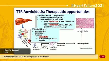 Cardiomyopathies: one of the leading causes of heart failure