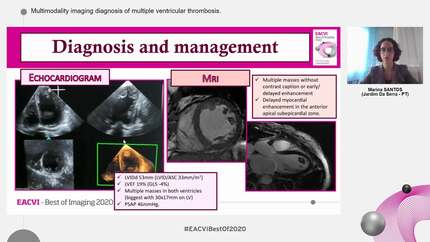 Presentation thumbnail