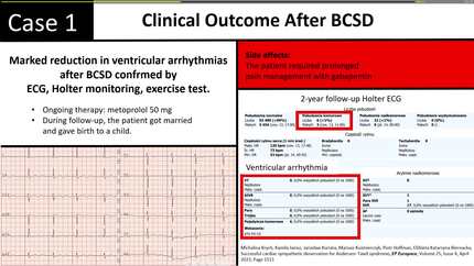 Effective bilateral cardiac sympathetic denervation in two women with Andersen–Tawil syndrome and drug-refractory ventricular arrhythmias