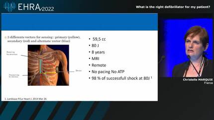 A change in hearts and minds: what informs your device choice?