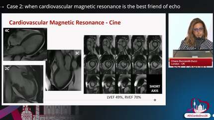 Presentation thumbnail